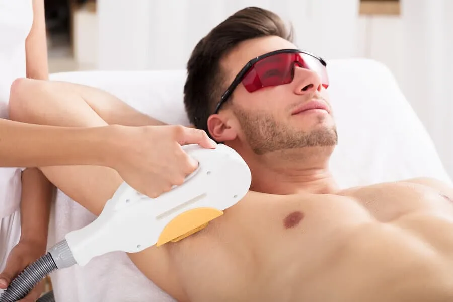 Epilazione laser uomo