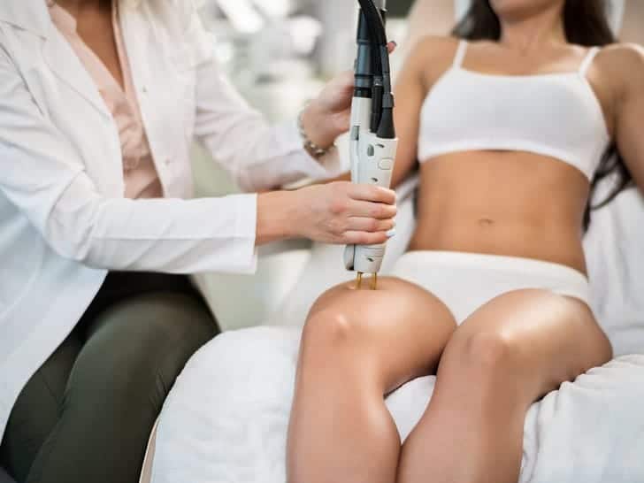 epilazione laser corpo donna
