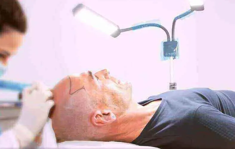 tricopigmentazione