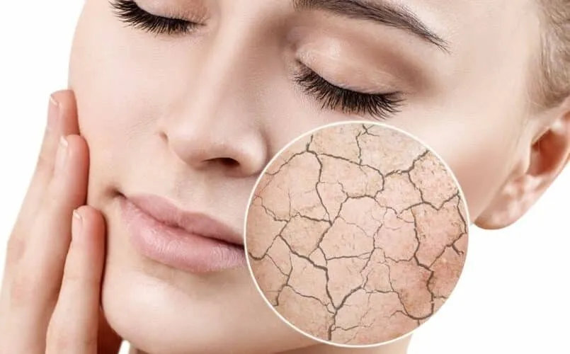 Pelle secca viso
