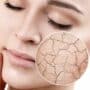 Pelle secca viso