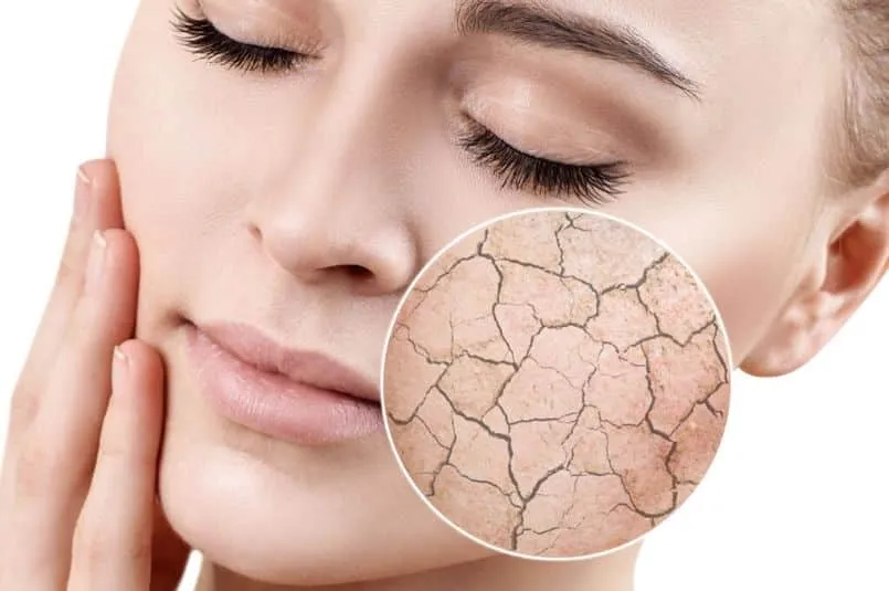 Pelle secca viso
