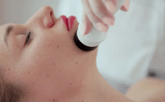 laserterapia macchie viso